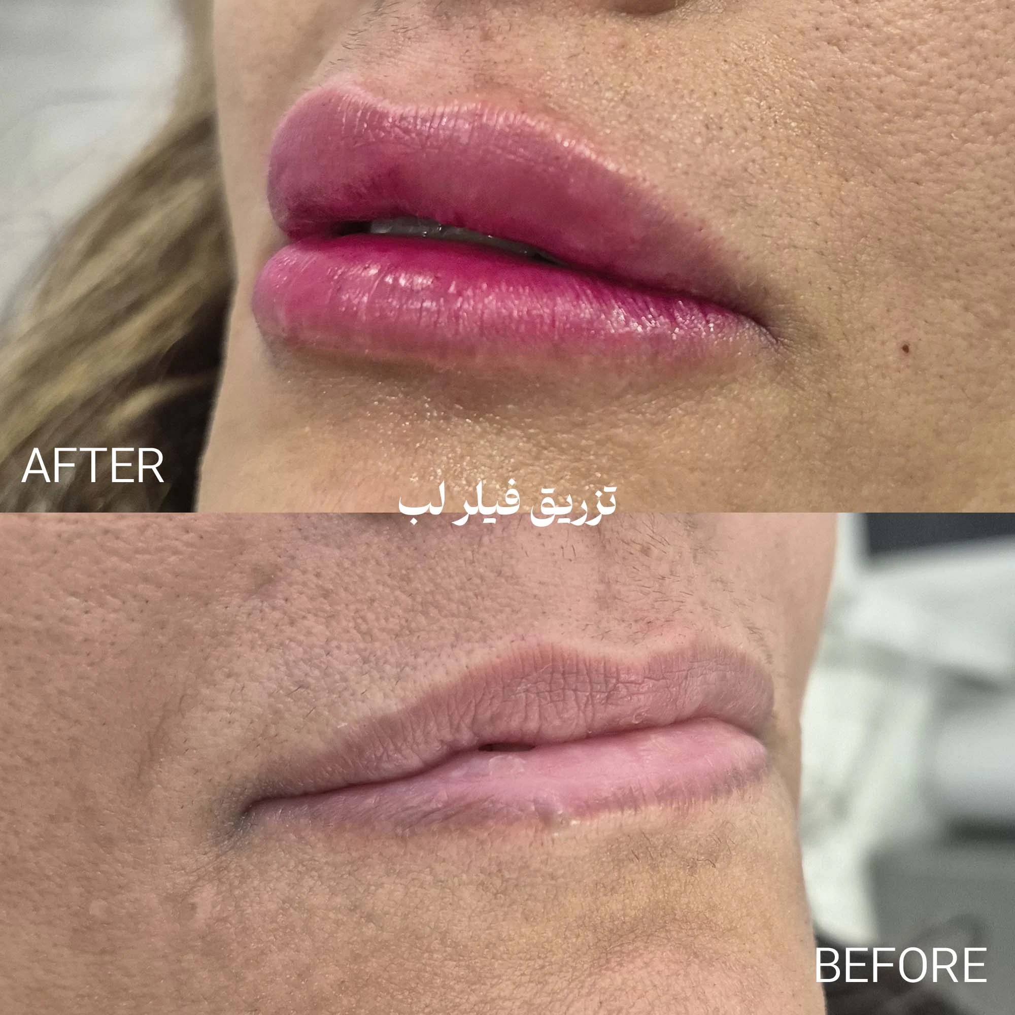 کلینیک لیزر و زیبایی دکتر لیلا حسینی - تصویر 2