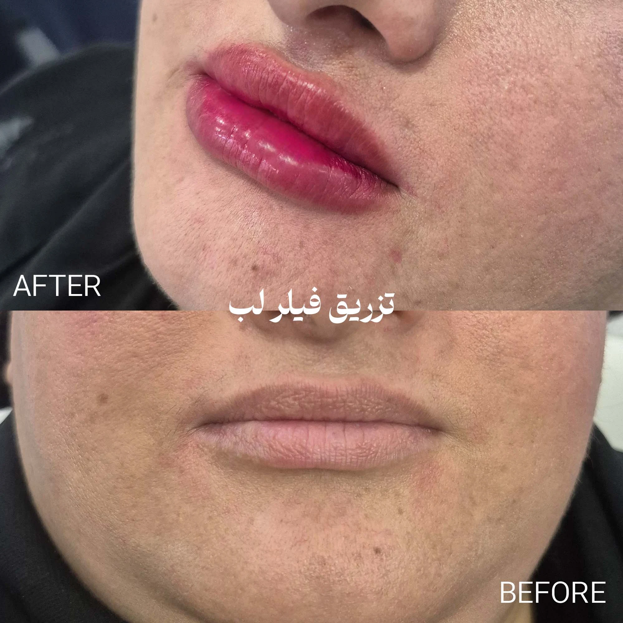 کلینیک لیزر و زیبایی دکتر لیلا حسینی - تصویر 4