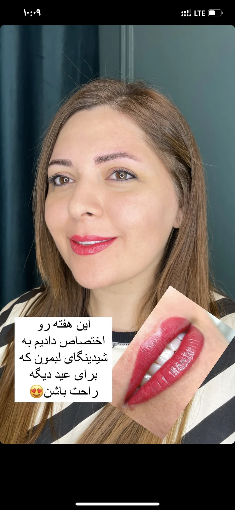 آموزش و خدمات شیدینگ لب و فیبروز هانیه پگاه - تصویر 3