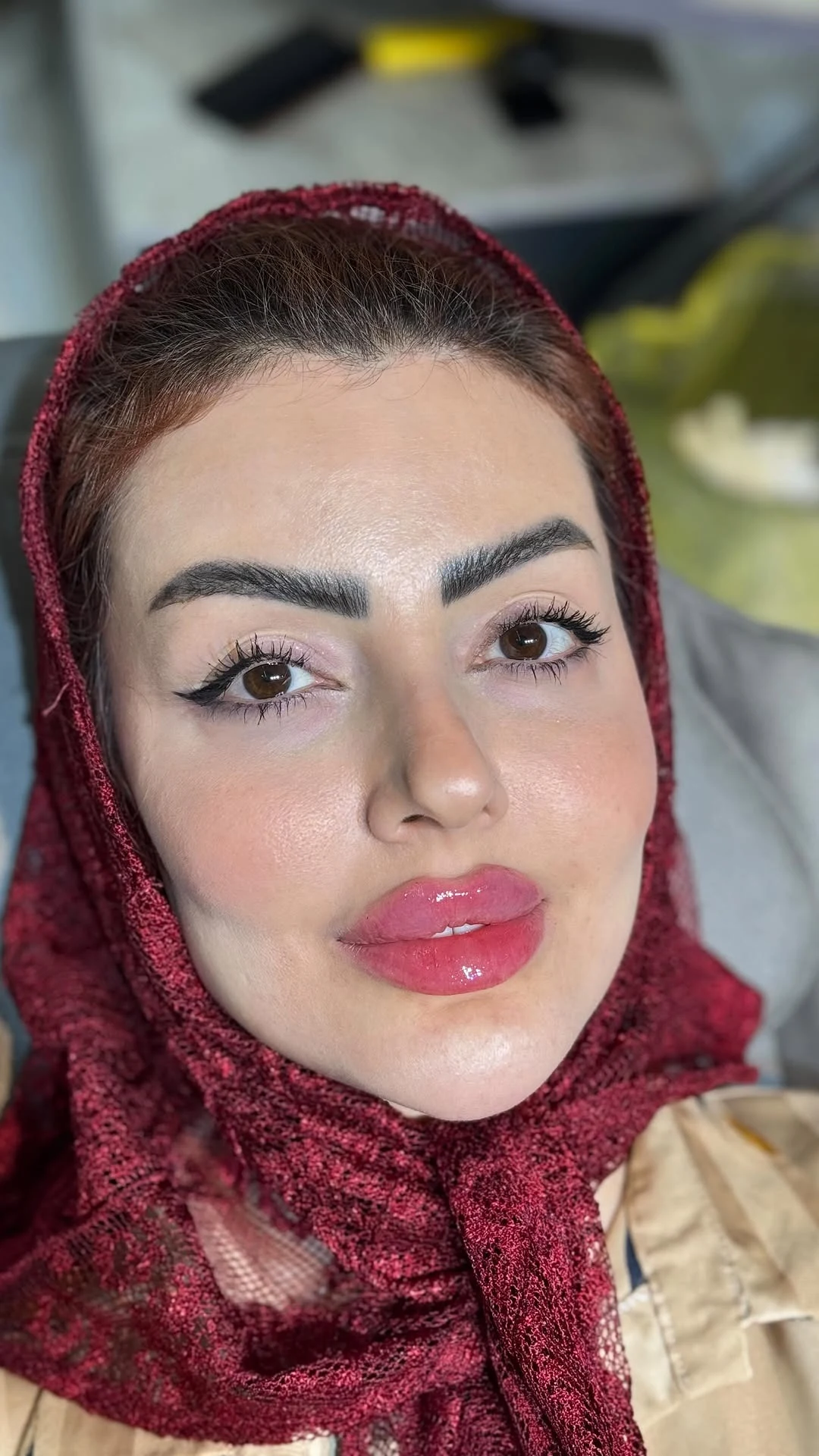 کلینیک زیبایی گلین - تصویر 2