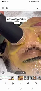 آموزش پاکسازی وفیشیال تخصصی