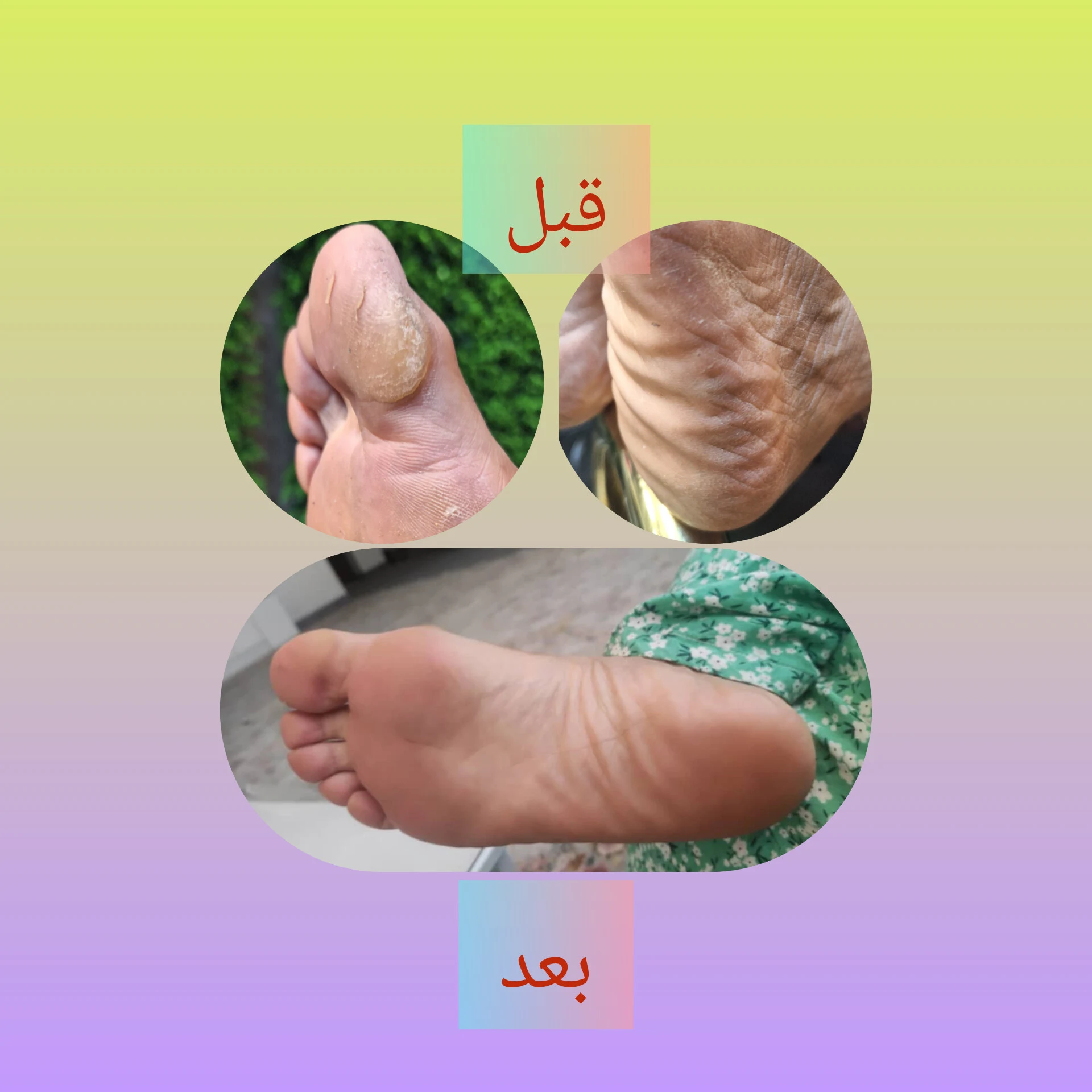اسپا پدیکور پا طیبه انتظاری - تصویر 3