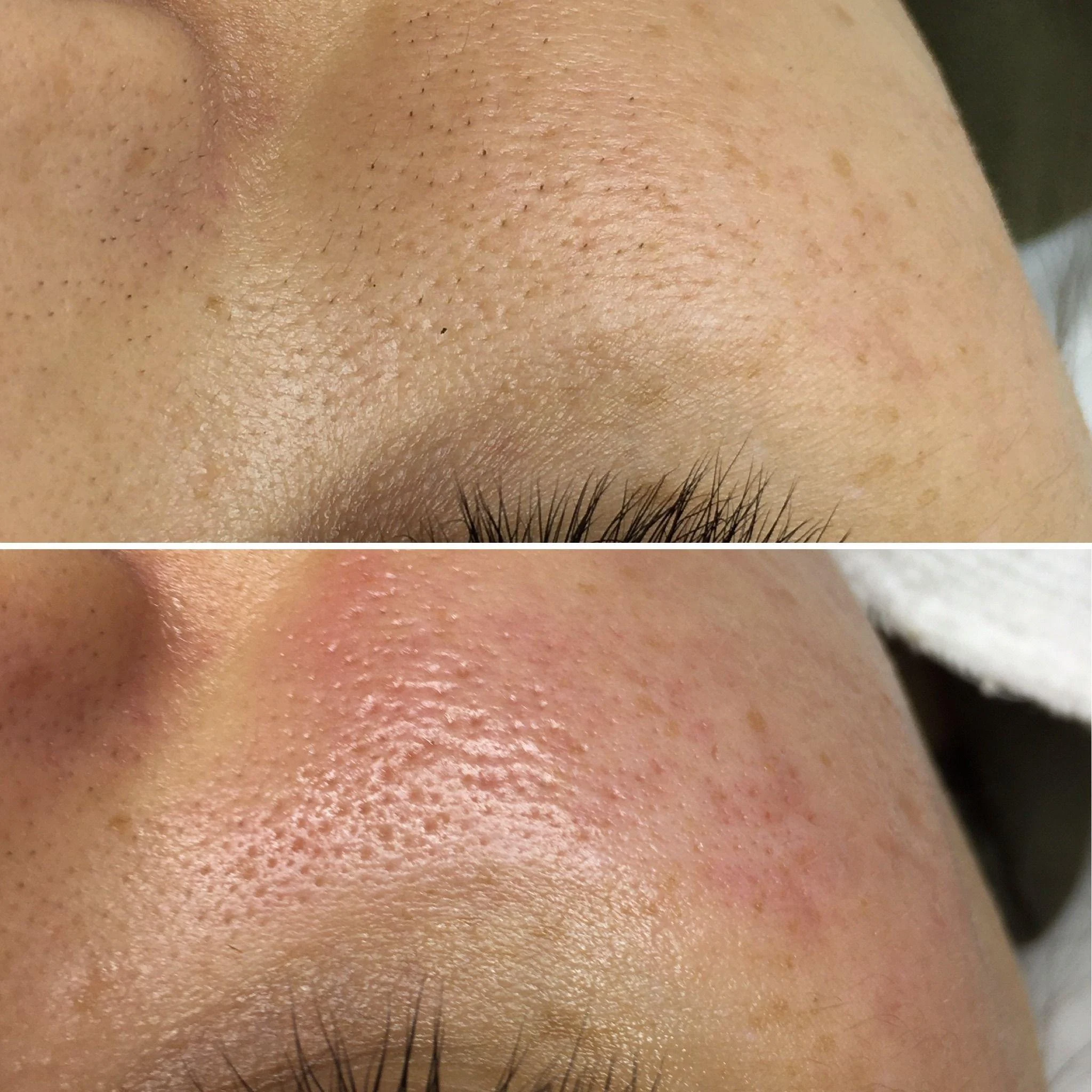 فیشیال و پاکسازی تخصصی پوست
