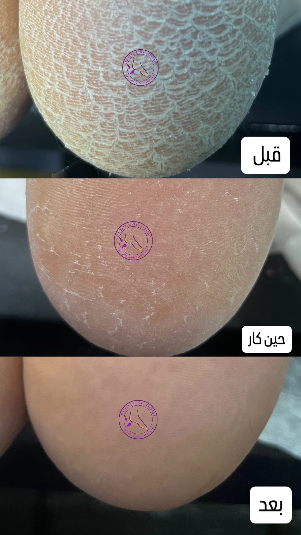 پدیکور تخصصی قم| فاطمه اقامحمدی - تصویر 3