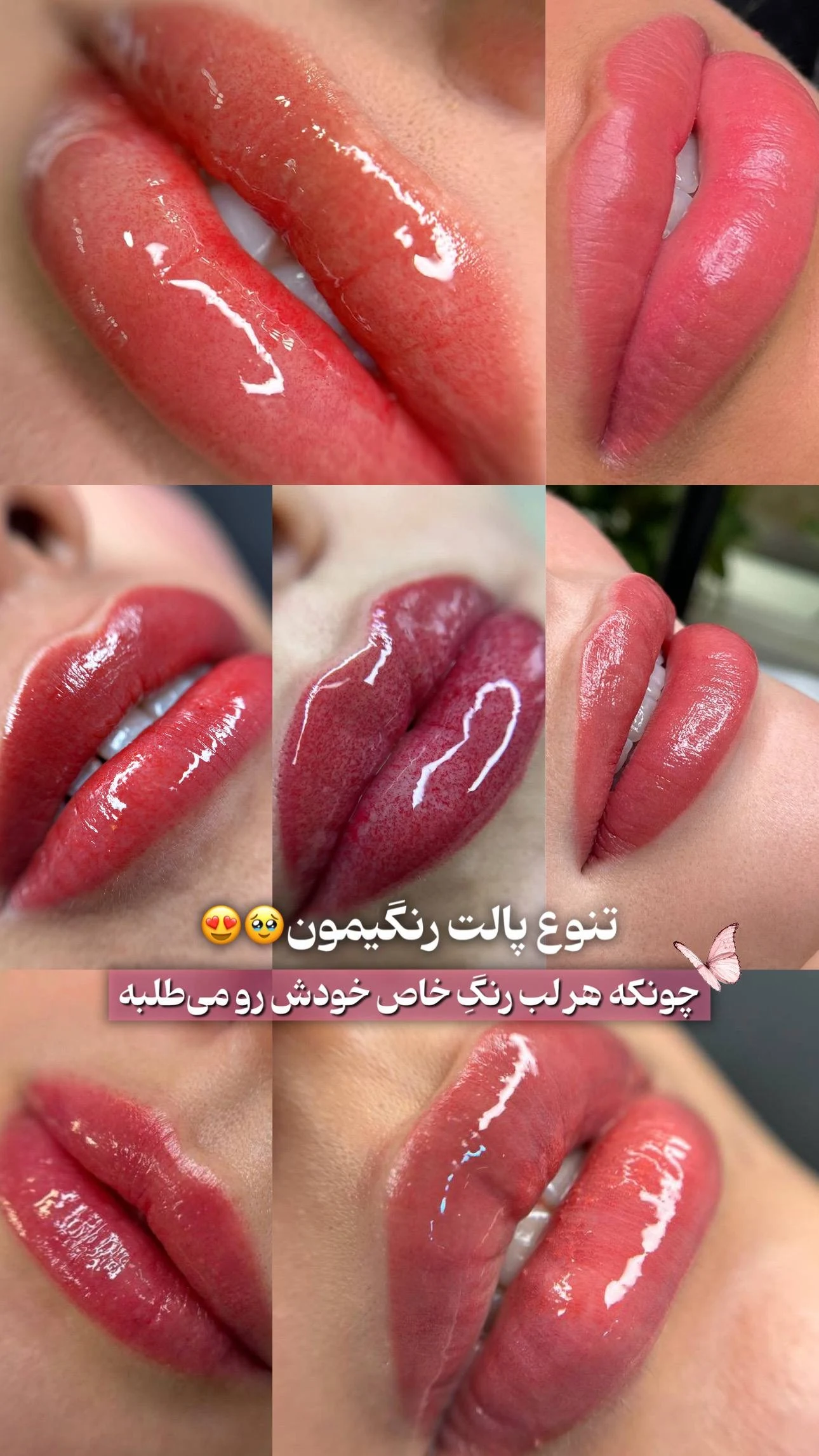 مرکز تخصصی شیدینگ لب بدون درد در قم - تصویر 2