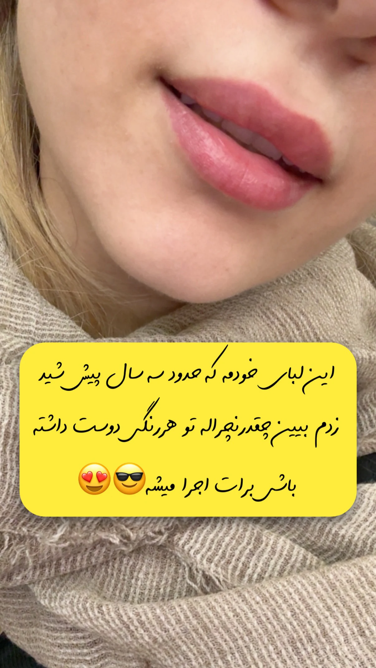 مرکز تخصصی شیدینگ لب بدون درد در قم - تصویر 4