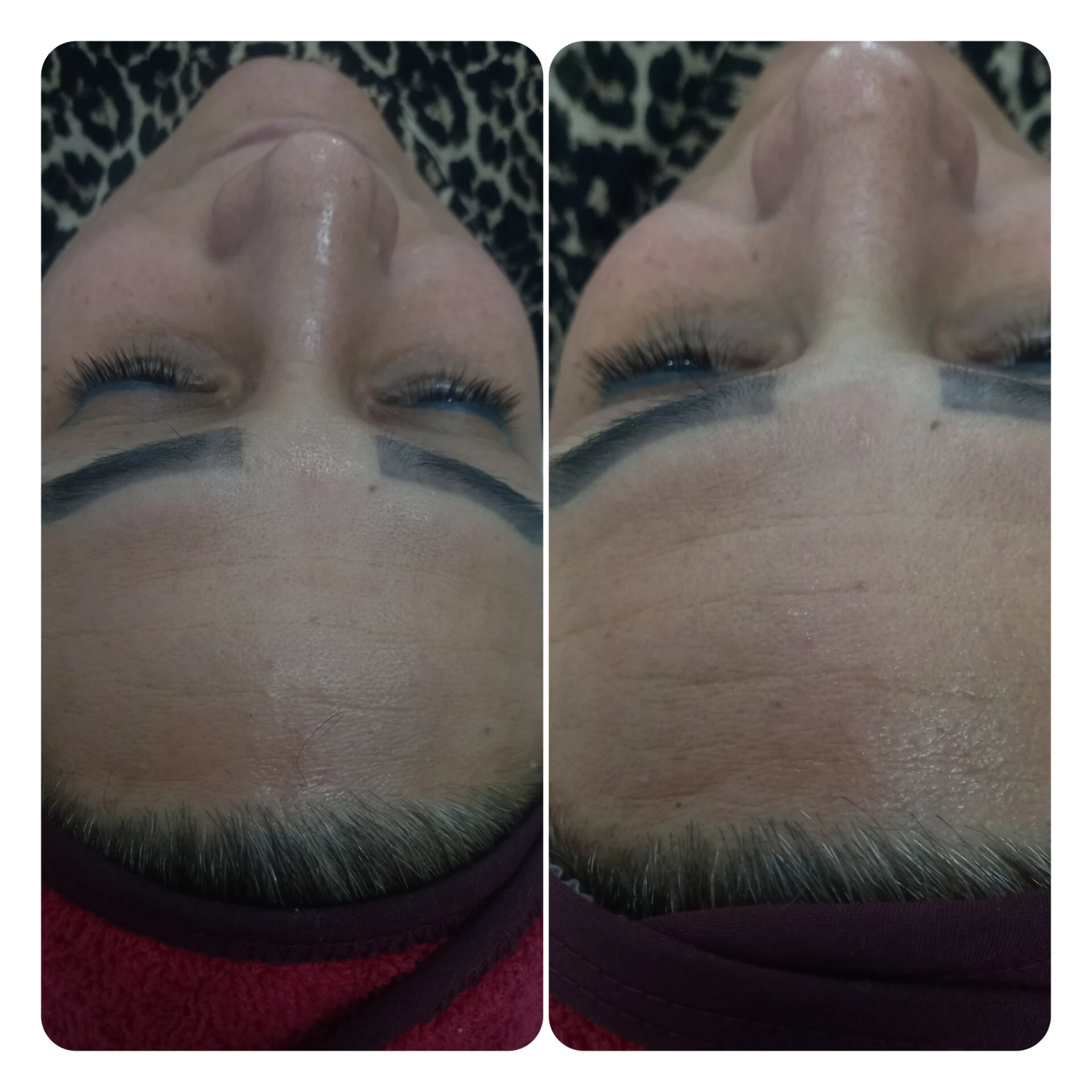 فشیال تخصصی درمانی سماء مانم - تصویر 3