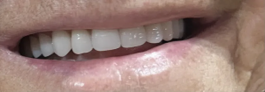 دندانسازی حسن پور جوان