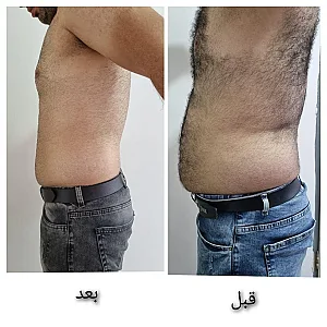 کلینیک تغذیه و رژیم درمانی امگا
