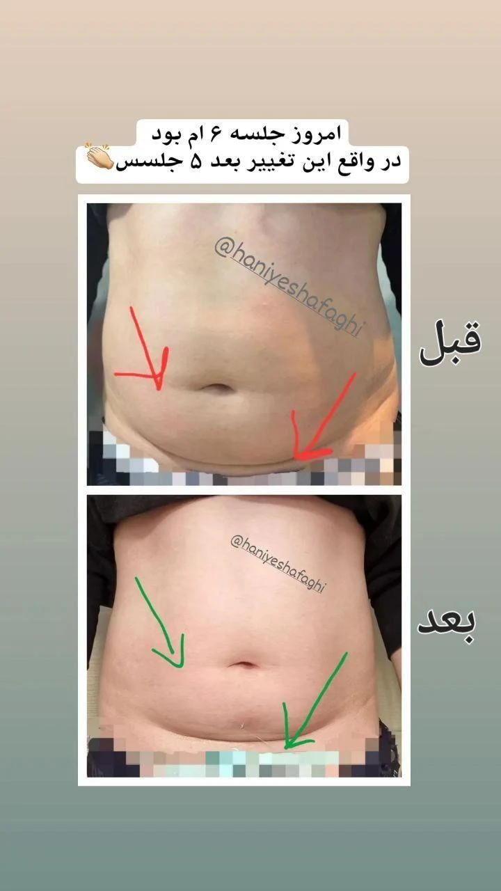 کلینیک تغذیه و رژیم درمانی امگا - تصویر 2