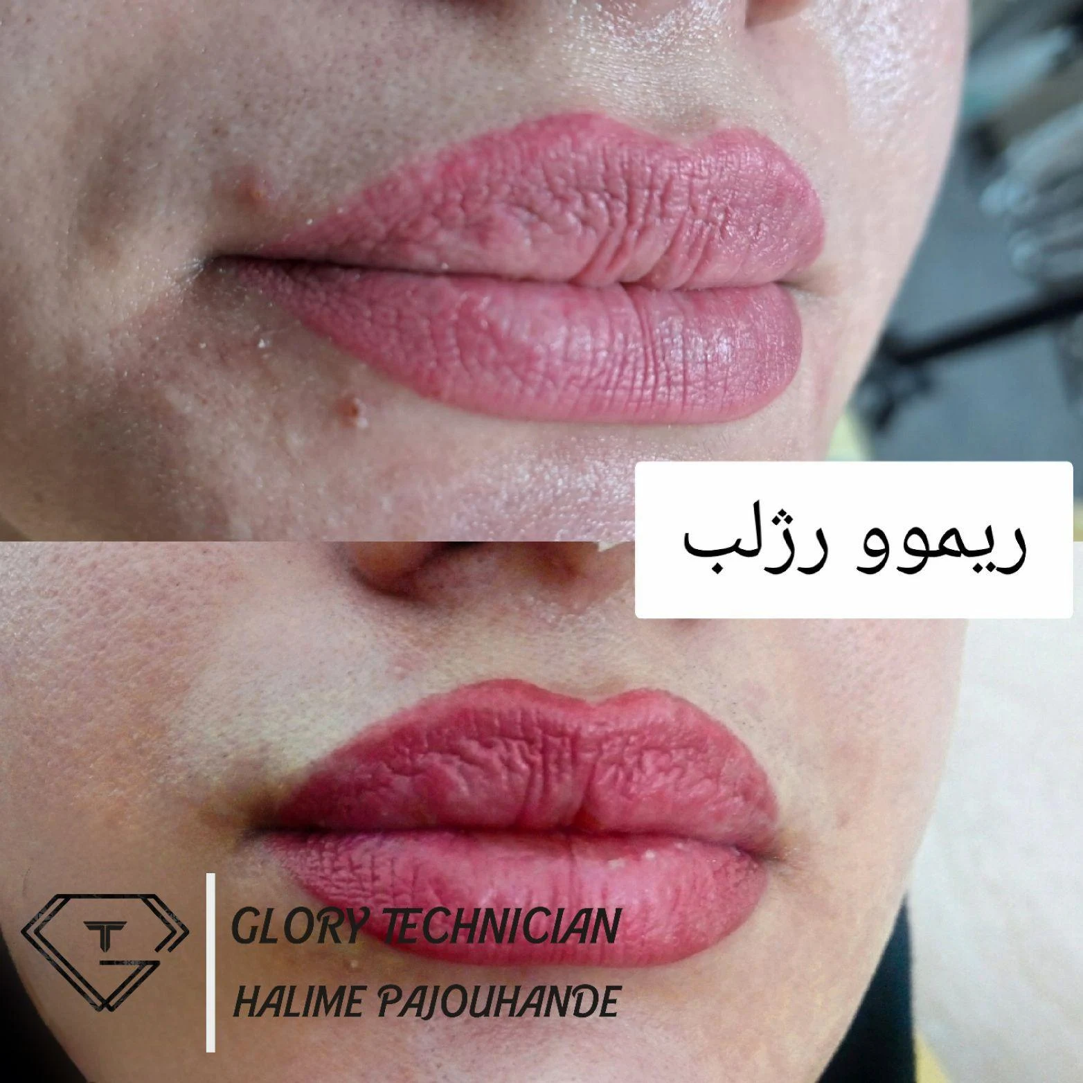 ریموو تتو ابرو  میکروبلیدینگ ابرو شیدینگ لب - تصویر 2