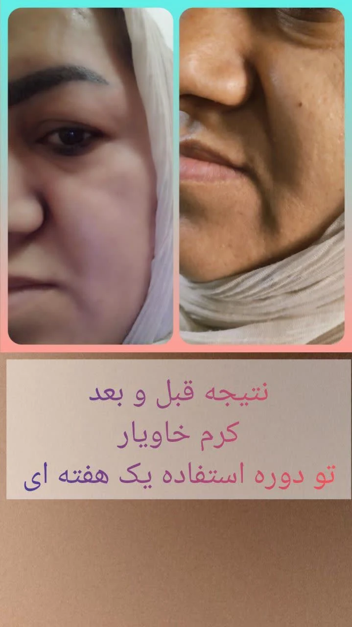 مشاور پوست و مو مهدی زاده - کلینیک پوست و زیبایی در شیراز - تصویر 5