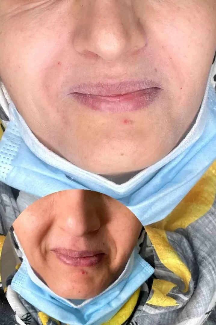 کلینیک زیبایی و لاغری الا بیوتی سنتر - کلینیک پوست و زیبایی در کرج - تصویر 4