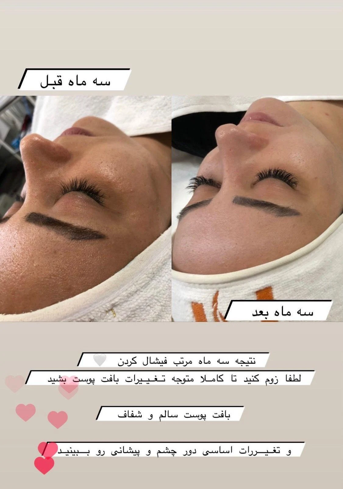 متخصص پوست - آموزشگاه آرایشگری در تبریز