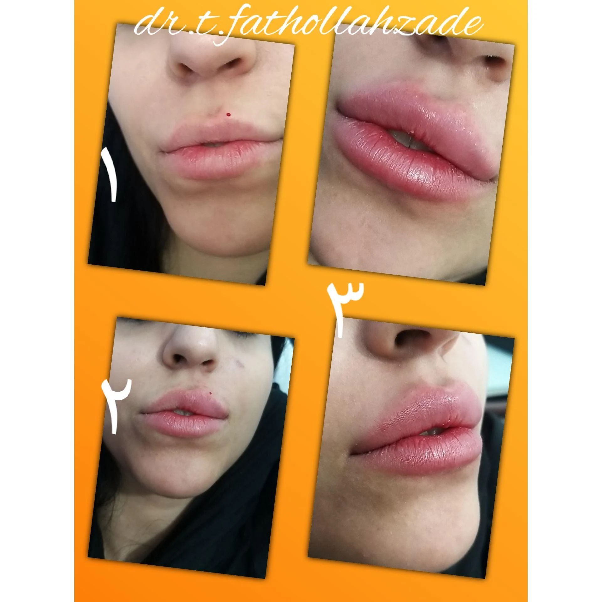 مطب پوست و مو و لیزر  ارکیده - کلینیک پوست و زیبایی در تبریز
