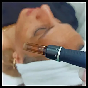 فیشال تخصصی و اسکراب اسکالپ سر مونا