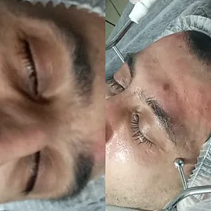 خدمات تخصصی فیشال  مرجان بیوتی
