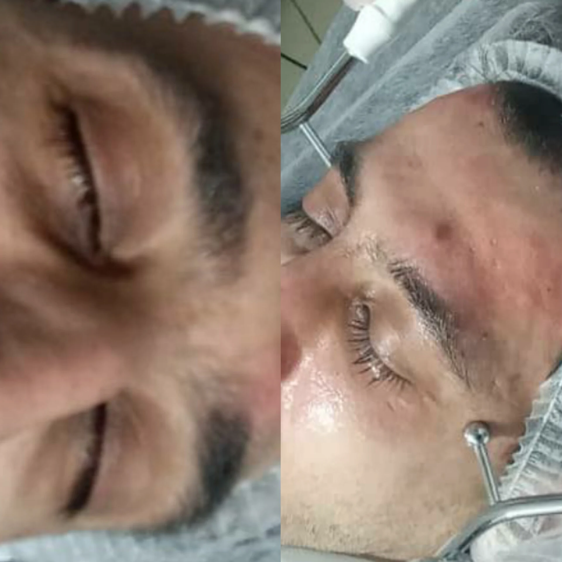 خدمات تخصصی فیشال  مرجان بیوتی