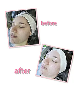 خدمات تخصصی پاکسازی پوست و فیشیال مهشید
