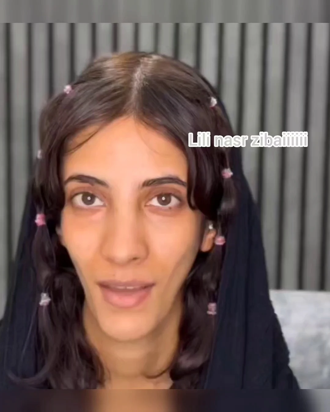 تزریق بوتاکس و ژل کانتور کامل صورت نصری - تصویر 5