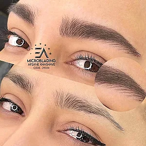 مرکز تخصصی میکروبلیدینگ ،میکروپیگمنتیشن