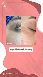 کلینیک زیبایی ژنـو « پزشکی بازساختی »
