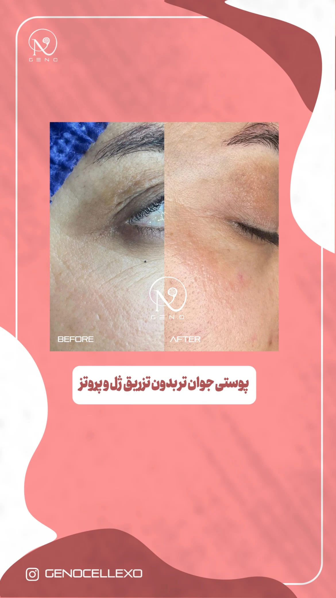کلینیک زیبایی ژنـو « پزشکی بازساختی »