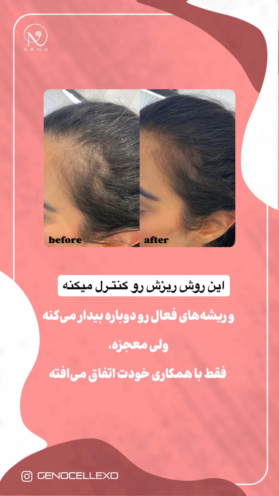 کلینیک زیبایی ژنـو « پزشکی بازساختی » - تصویر 4