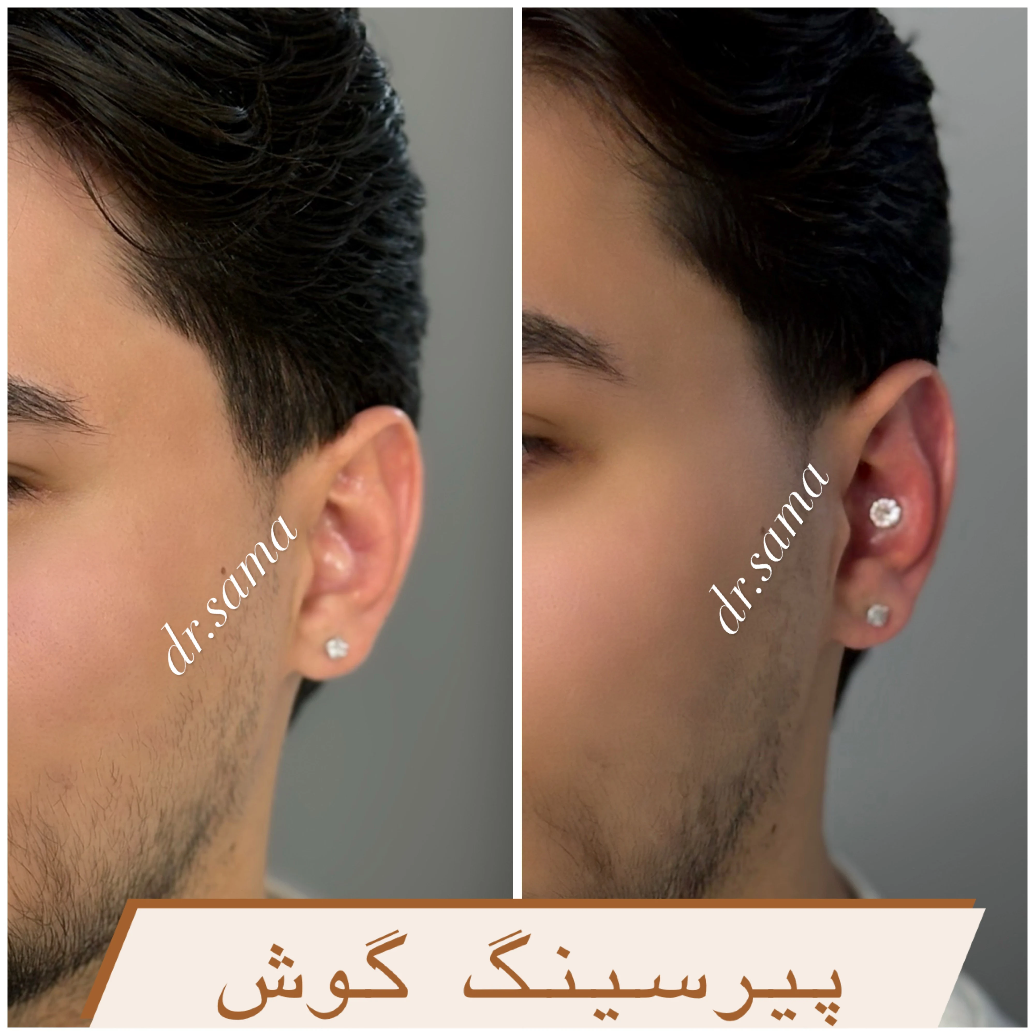 مطب زیبایی دکتر سما ( با تخفیف ویژه ) - آموزشگاه آرایشگری در مشهد