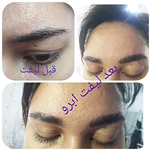 فشیال پوست، کاشت مژه،لیفت و لمینت ابرو و مژه