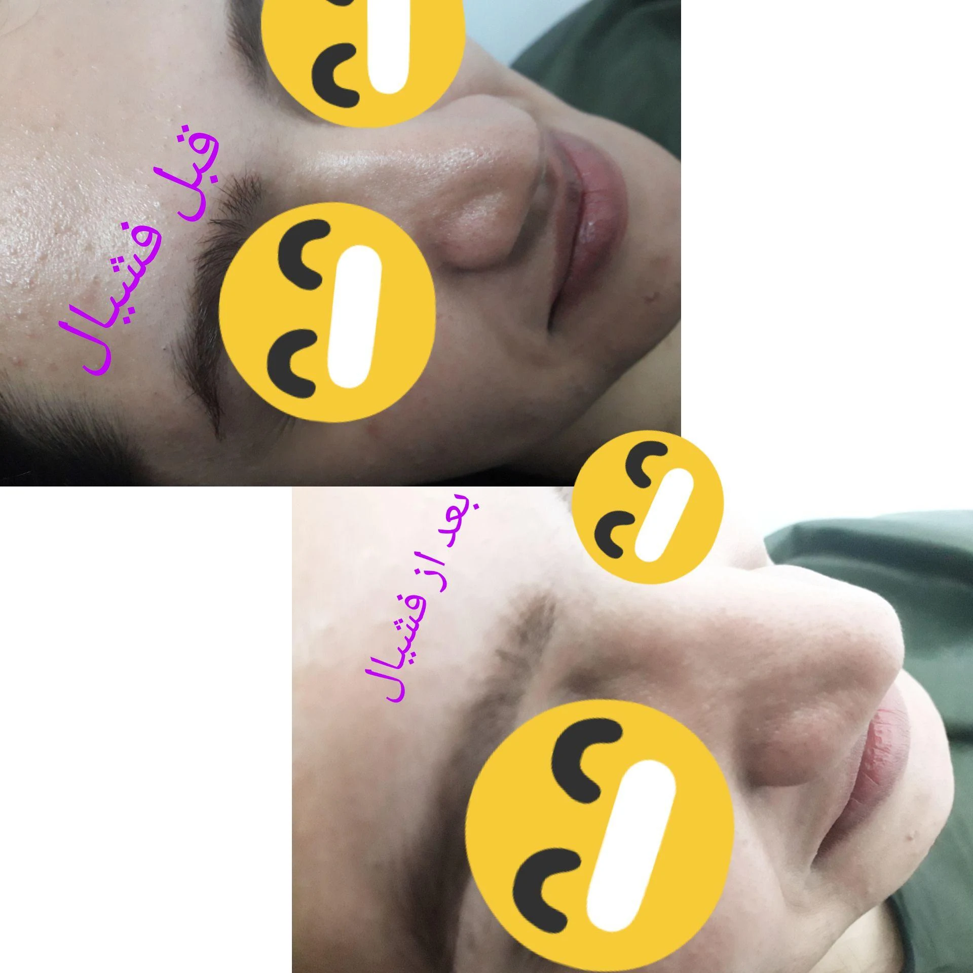 فشیال پوست، کاشت مژه،لیفت و لمینت ابرو و مژه - تصویر 3
