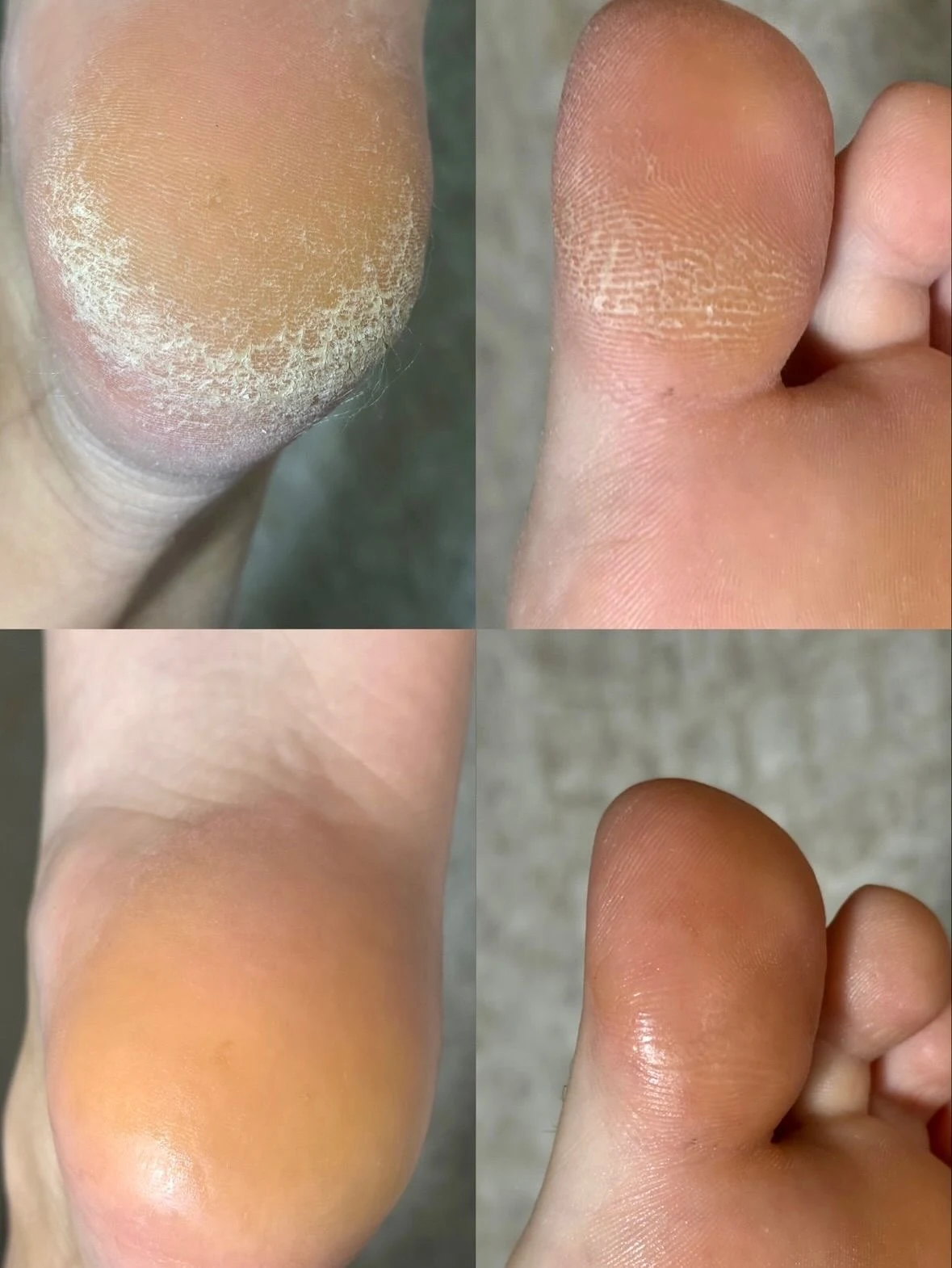 پدیکور و کفسابی پا اذرنوش - تصویر 2