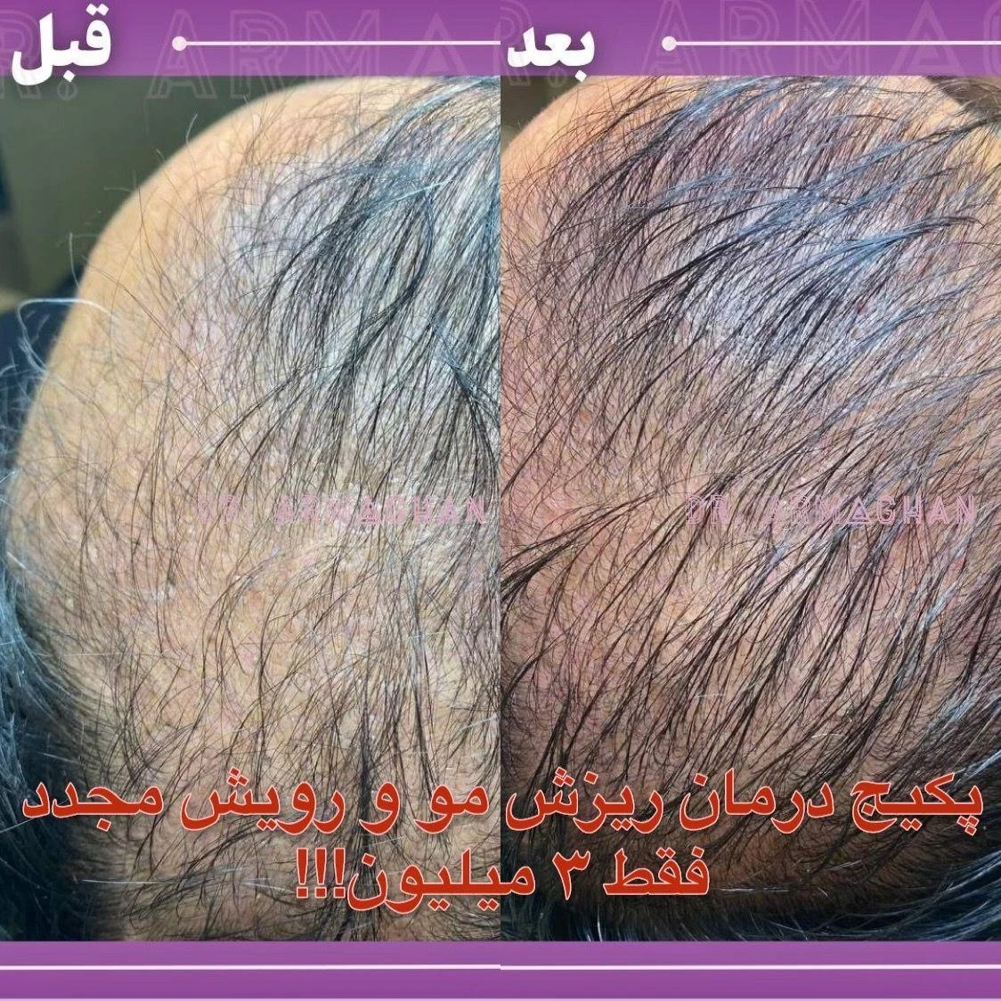 پزشک زیبایی دکتر ارمغان صادقی - تصویر 2