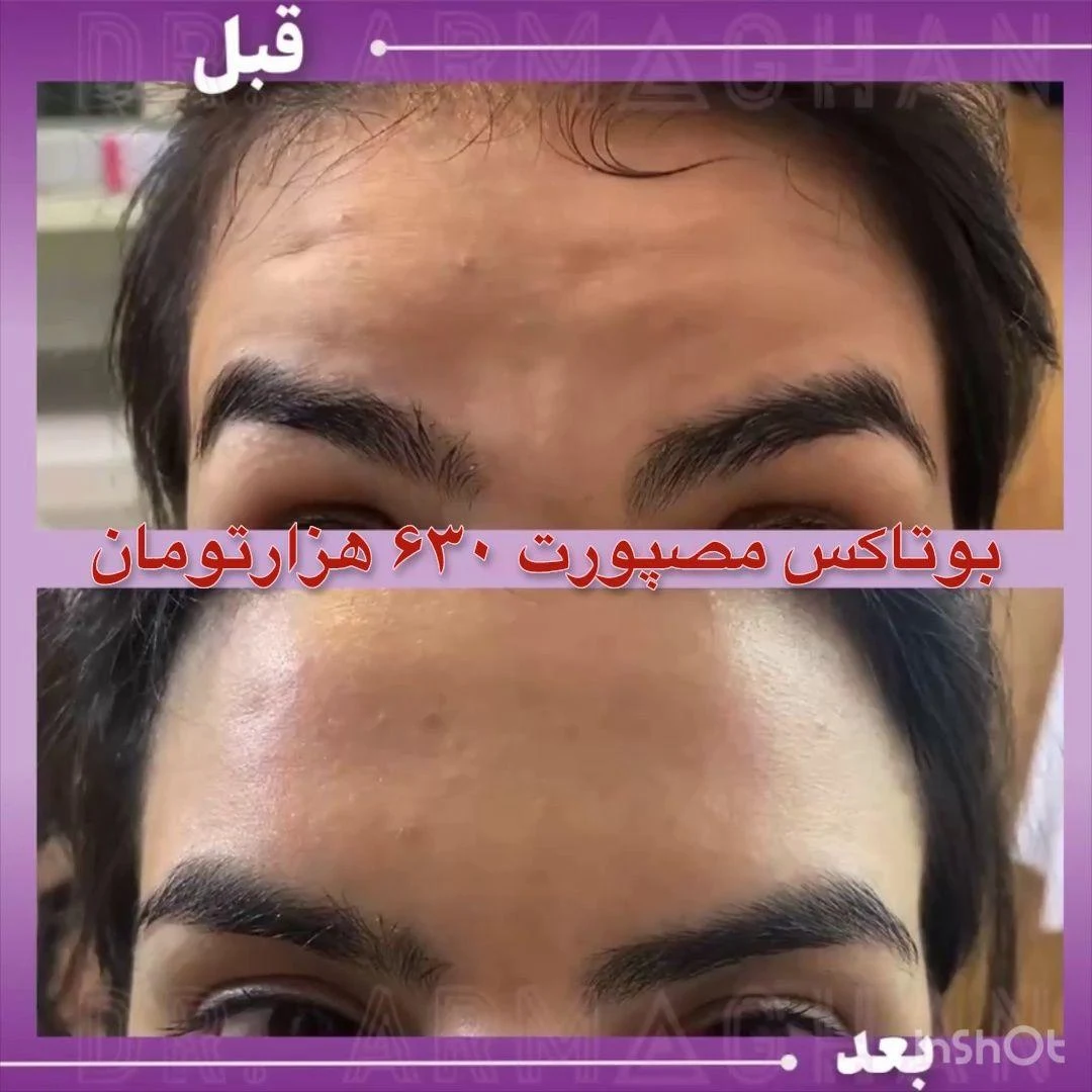 پزشک زیبایی دکتر ارمغان صادقی - تصویر 4