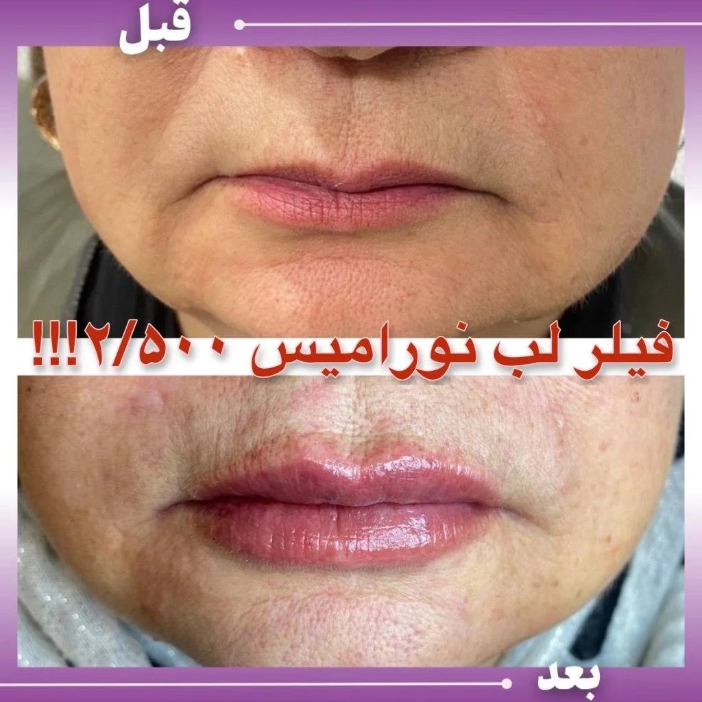 پزشک زیبایی دکتر ارمغان صادقی - تصویر 5