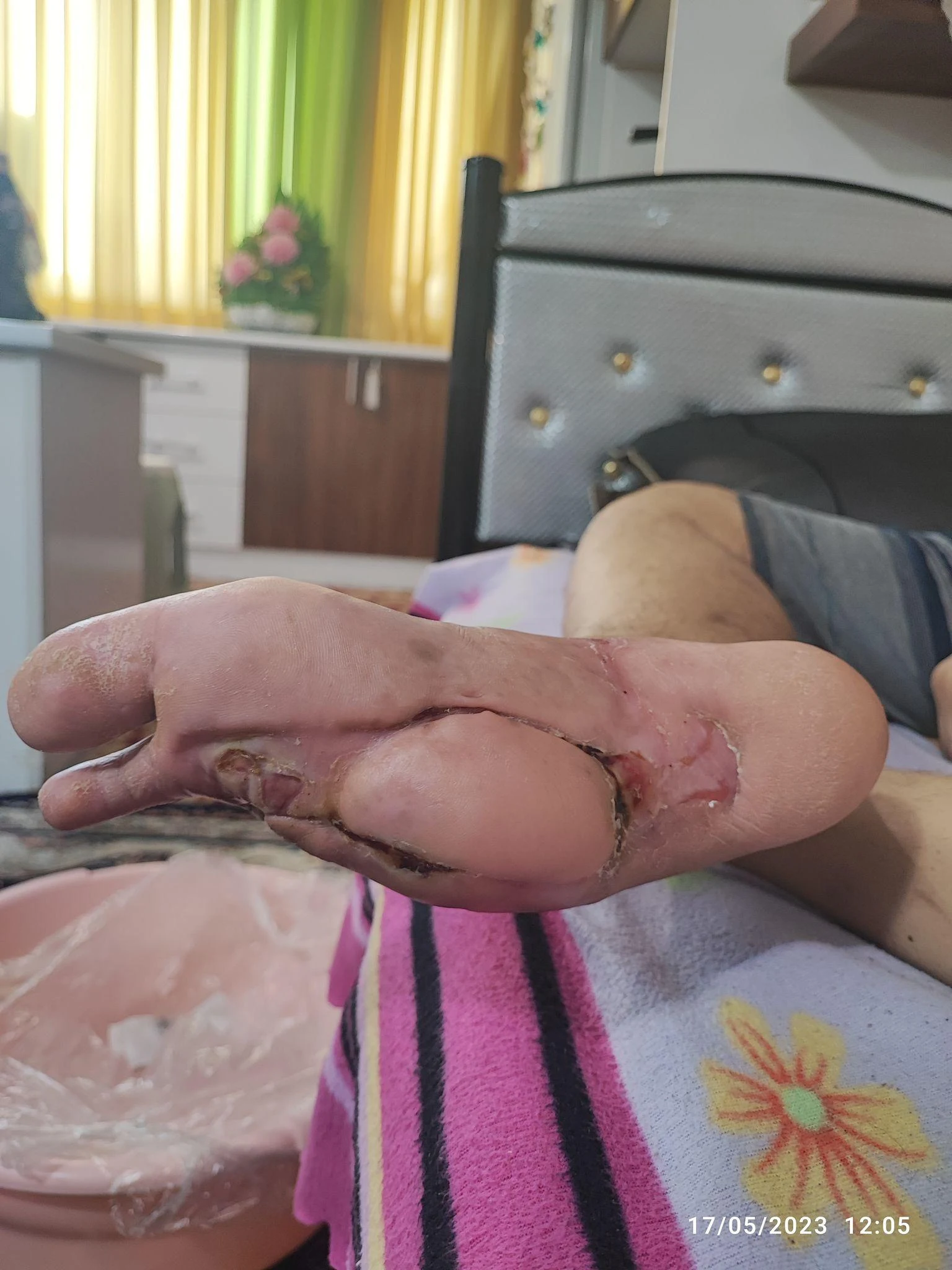 مرکز تخصصی درمان زخم تندیس تندرستی - خدمات پرستاری در منزل در مشهد - تصویر 2