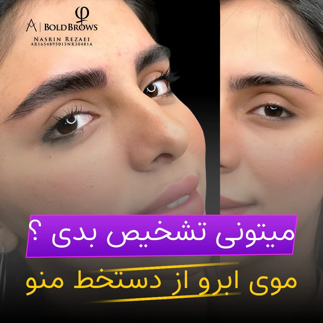 میکروبلیدینگ،فیبروز نسرین رضایی - تصویر 2
