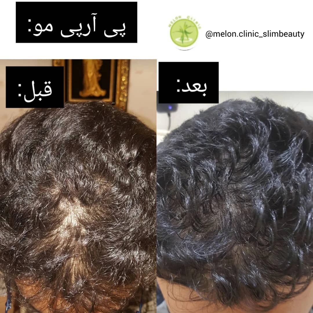 کلینیک زیبایی ملون - تصویر 4