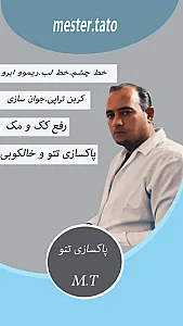 خدمات لیزر مستر تتو.