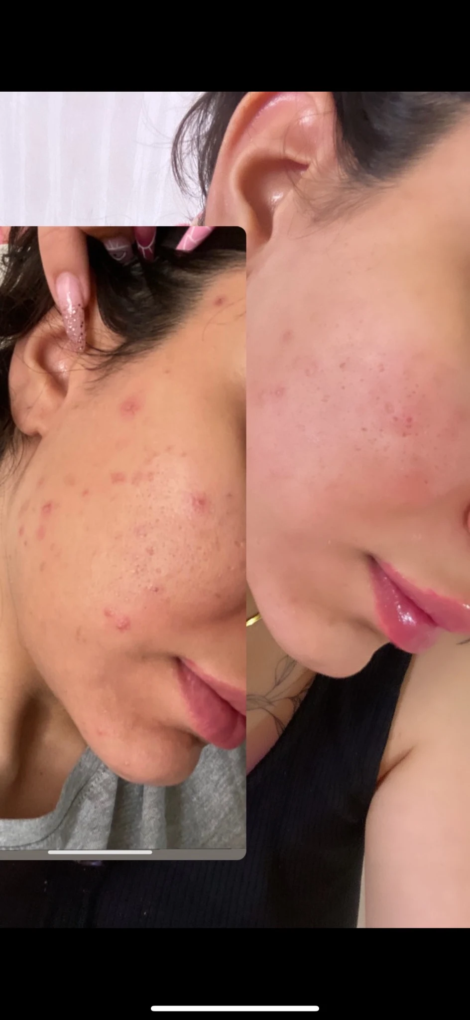 پاکسازی پوست و فیشیال طهورا (پنس بیوتی) - تصویر 2