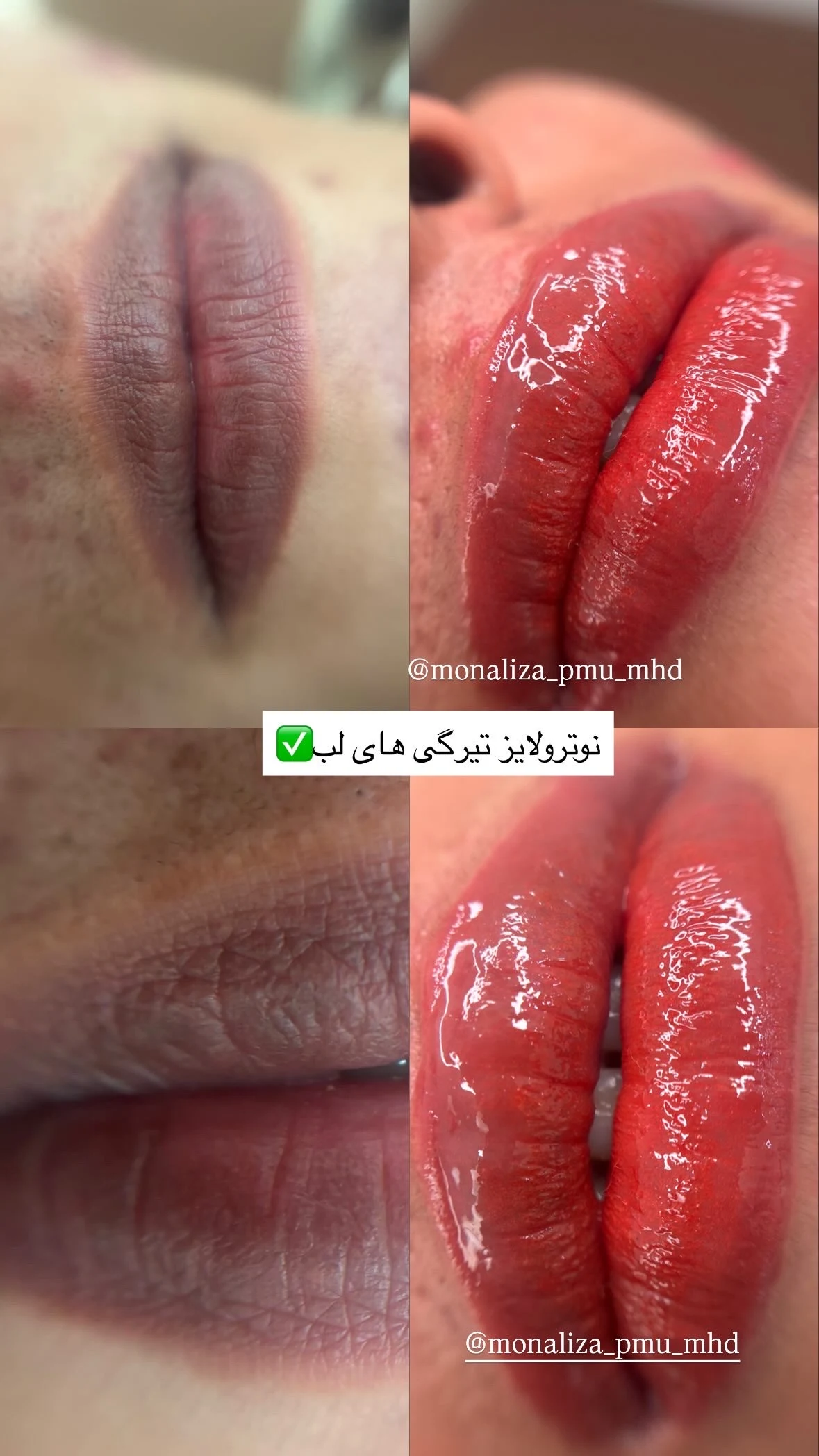 خدمات تخصصی آرایش دائم مشهد - تصویر 5