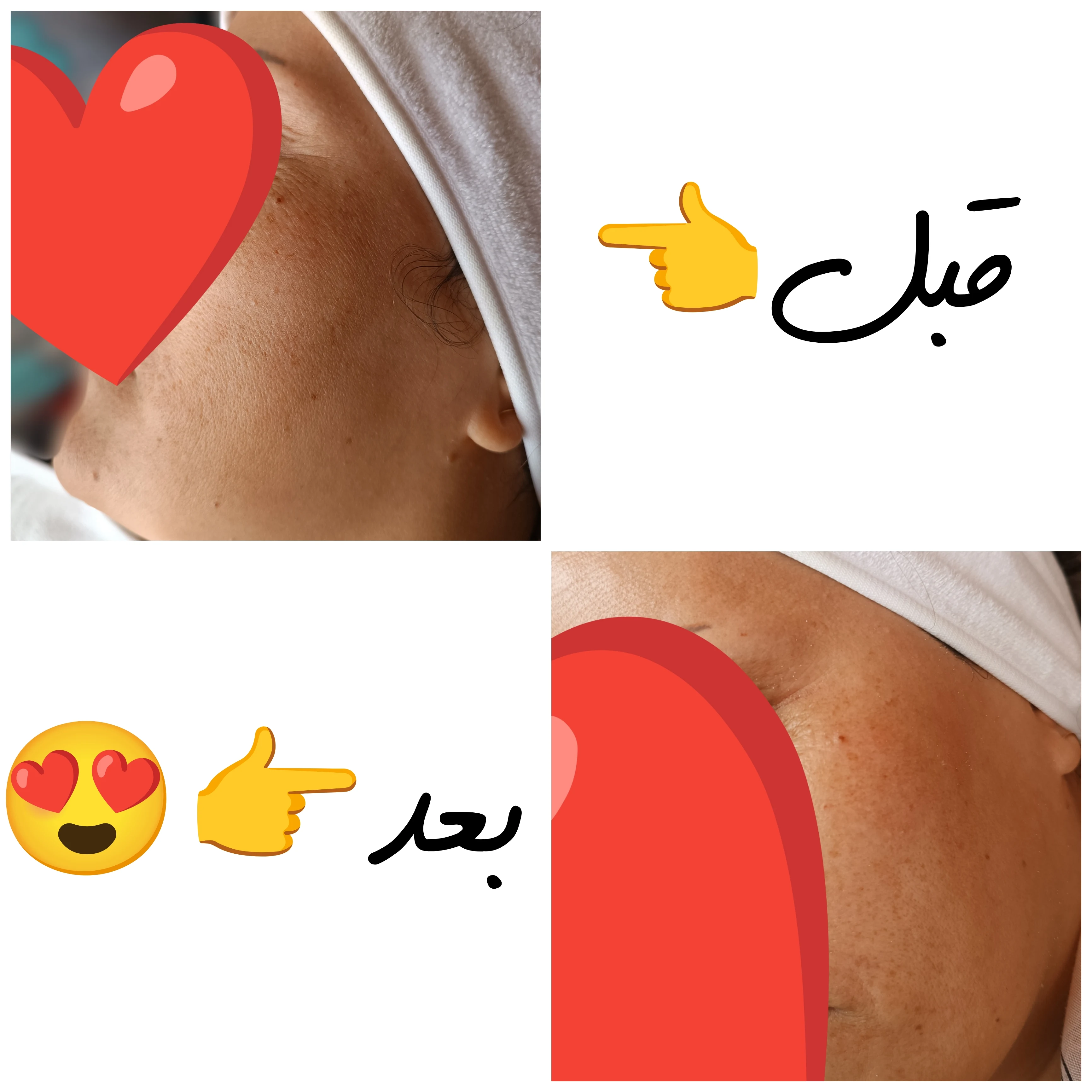 مراقبت پوست زهرا جابری - تصویر 3