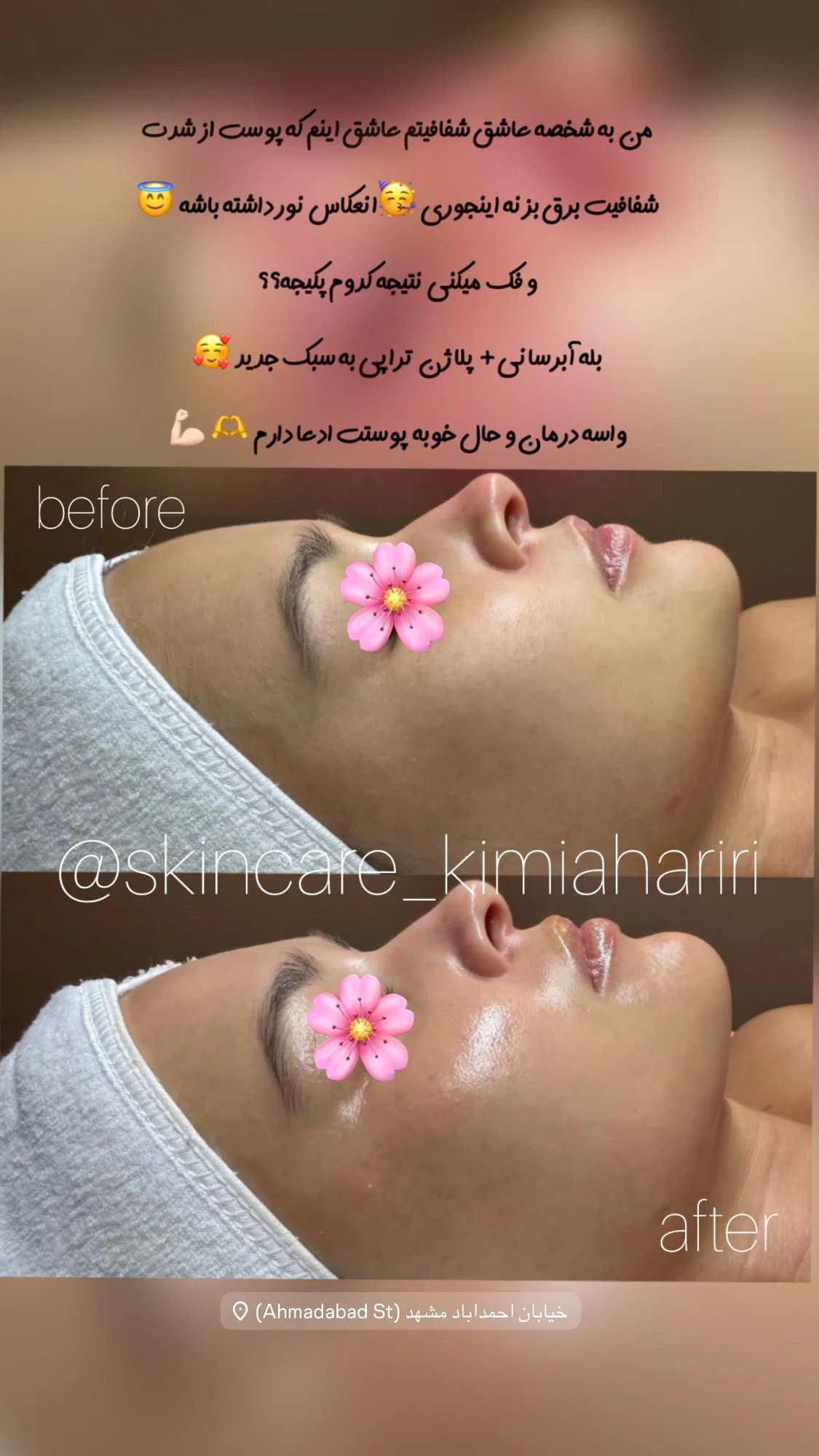 پاکسازی پوست با مدرک فنی حرفه ای(حریری) - تصویر 2