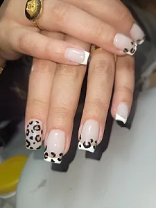 کاشت ناخن در مشهد