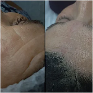 خدمات تخصصی پوست جوانسازی