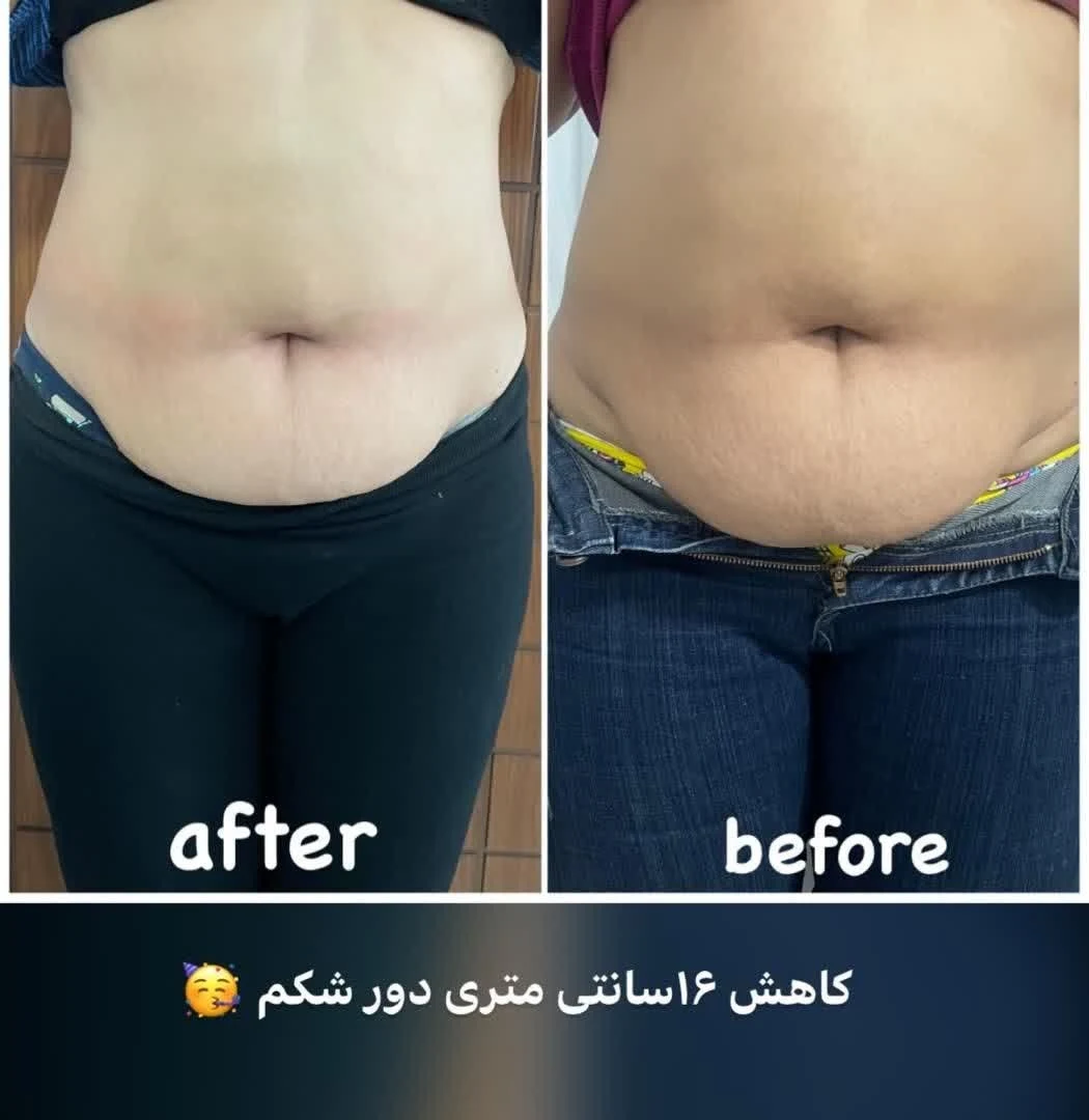 خدمات زیبایی دکتر محدثه حج فروشان - تصویر 4